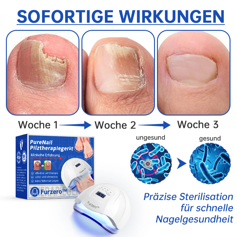 PureNail™  Die effektive Lösung gegen Nagelpilz – Für gesunde, schöne Nägel