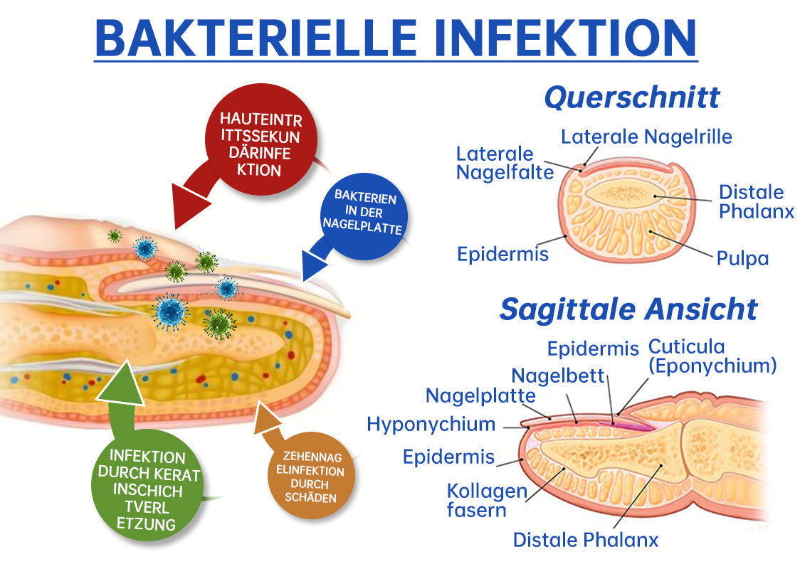 PureNail™  Die effektive Lösung gegen Nagelpilz – Für gesunde, schöne Nägel