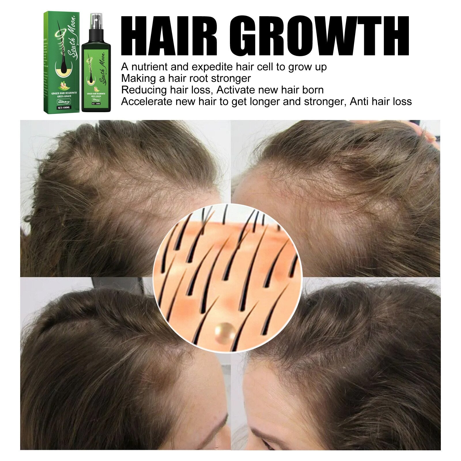 GrowthPlus™ Nährendes Ingwer-Spray - Das Geheimnis für stärkeres und schnelleres Haarwachstum!