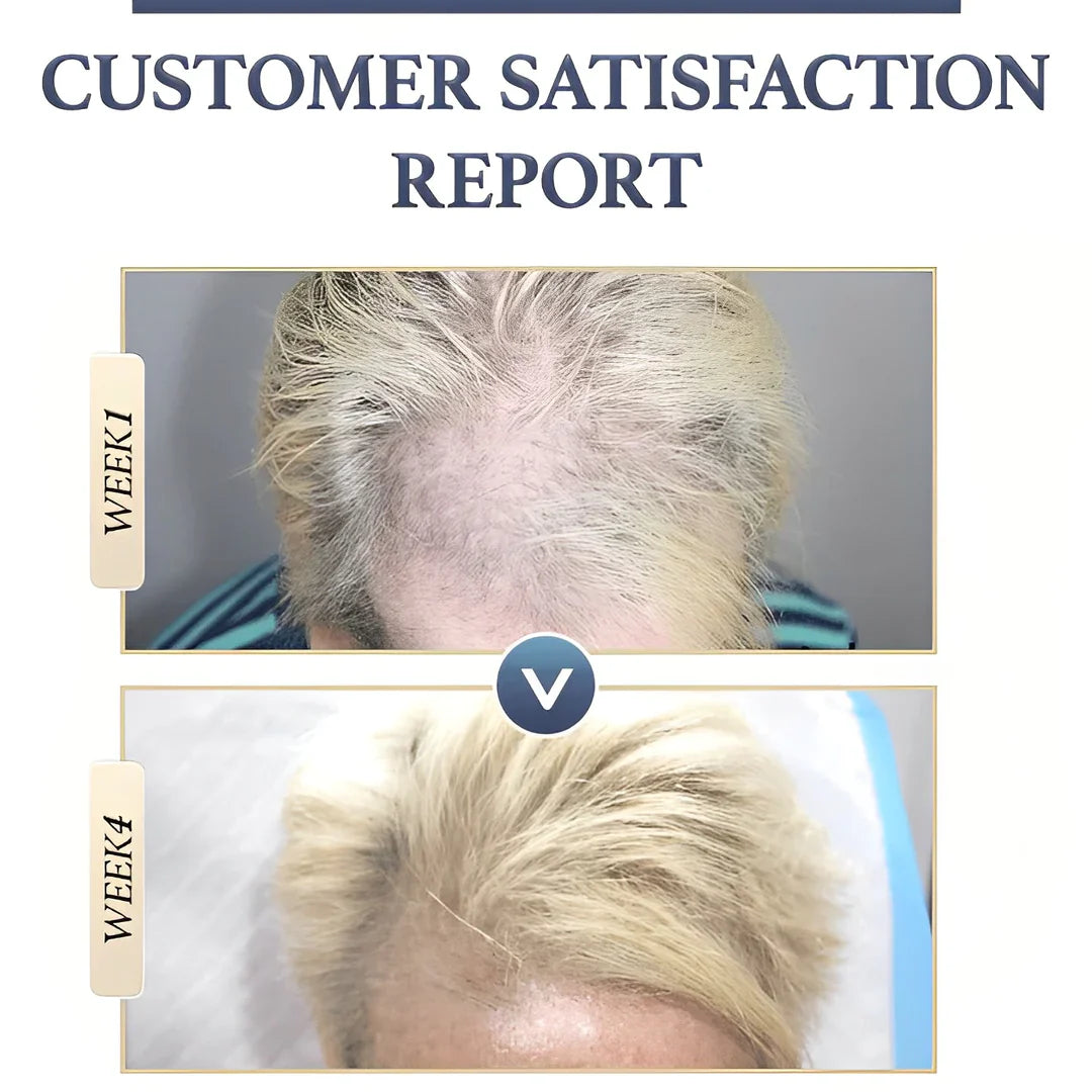 HairVital™ Haarwachstums-Booster